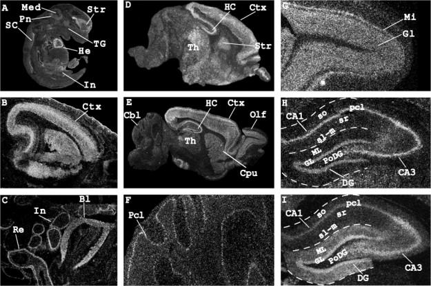 Neuralized-2: Expression in human and rodents and interaction with Delta-like ligands