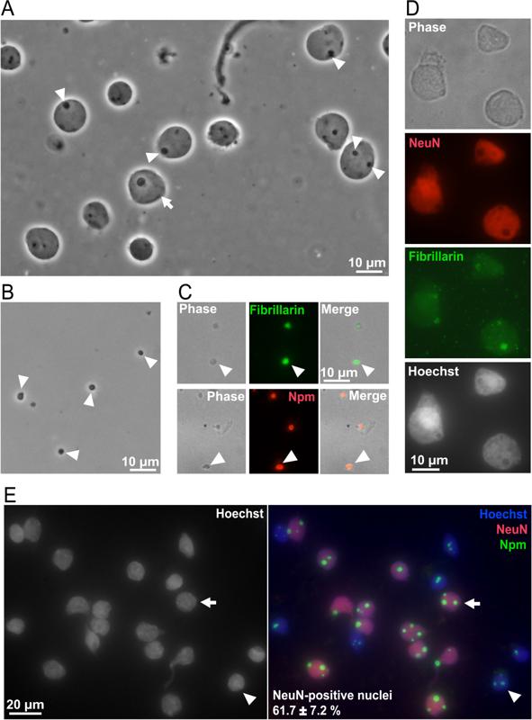 Nucleolar Enrichment of Brain Proteins with Critical Roles in Human Neurodevelopment